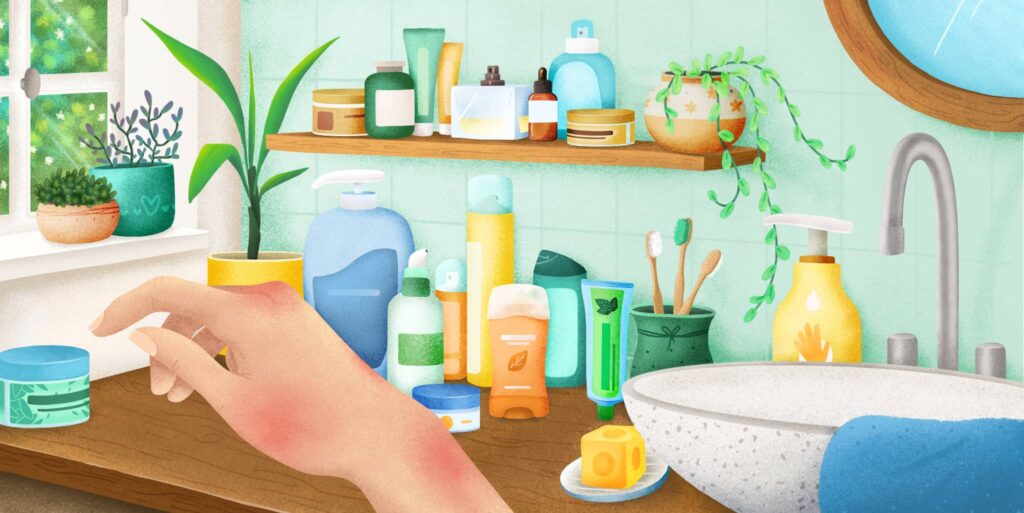 Skin Allergies